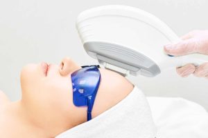 ipl treatment