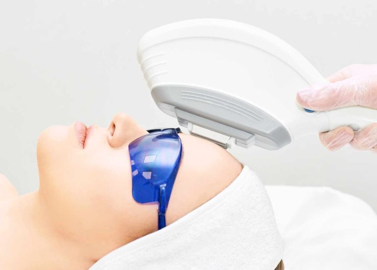 ipl treatment