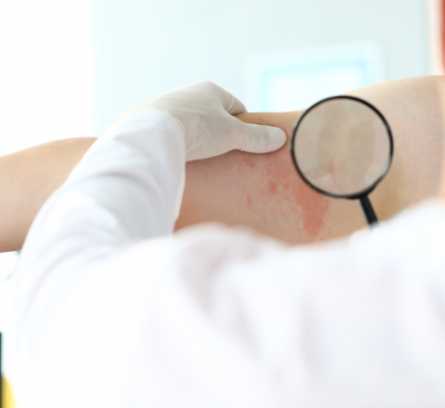 Atopic Dermatitis Treatments In GA - Skin Care Physicians doctor examining atopic dermatitis on patient in GA